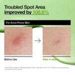 ⁦سيروم أنوا بحمض الأزيليك 10% والهيالورونيك لتهدئة الاحمرار – 30 مل⁩ - الصورة ⁦5⁩