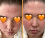 ⁦سكينتامين SkinTamin مع Veggie Collagen – 30 كبسولة⁩ - الصورة ⁦4⁩