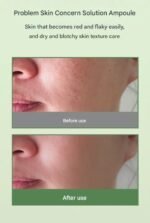 ⁦أمبول 3W Clinic Lab سيكا وحمض الهيالورونيك المهدئ – 50 مل⁩ - الصورة ⁦2⁩